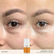 Picture of REN Clean Skincare Face Brightening Dark Circle Eye Cream 15ml