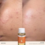 Picture of REN Clean Skincare Ready Steady Glow Daily AHA Tonic 250ml