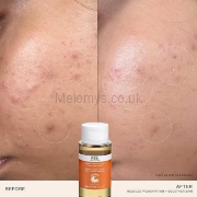Picture of REN Clean Skincare Ready Steady Glow Daily AHA Tonic 250ml